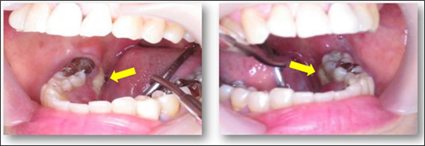 A close-up of a person's mouth Description automatically generated with low confidence